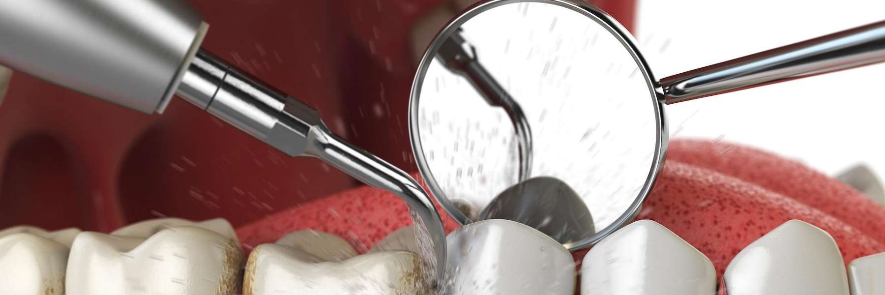 dental exams and cleanings in Watkinsville, GA