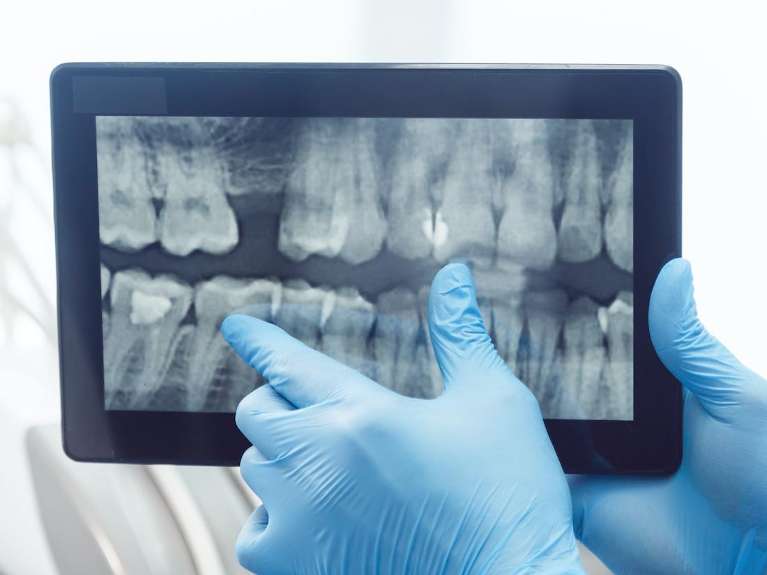 Dental X-Rays | Watkinsville Dentist