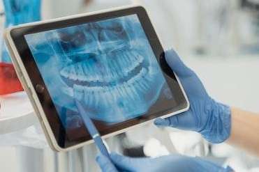 panoramic x-rays | watkinsville dentist